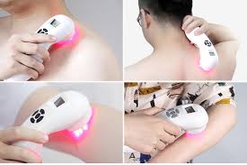 Laserbehandling